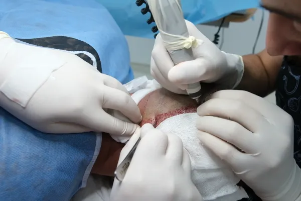 barba-donor
