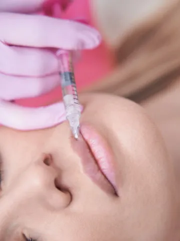 filler-labbra https://www.euroistanbul.it/wp-content/uploads/filler-labbra-300x400.webp