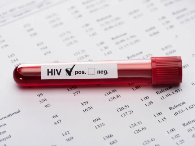 I malati di HIV possono sottoporsi a trapianto di capelli?